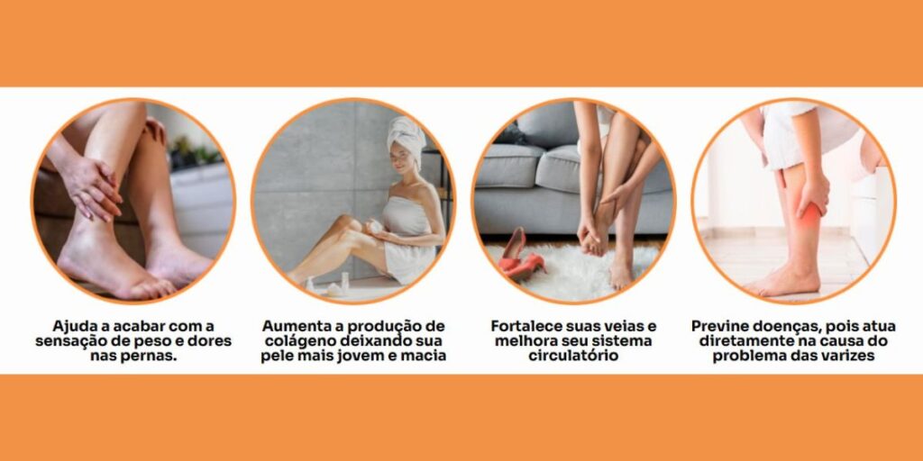 tratamento de varizes biovein